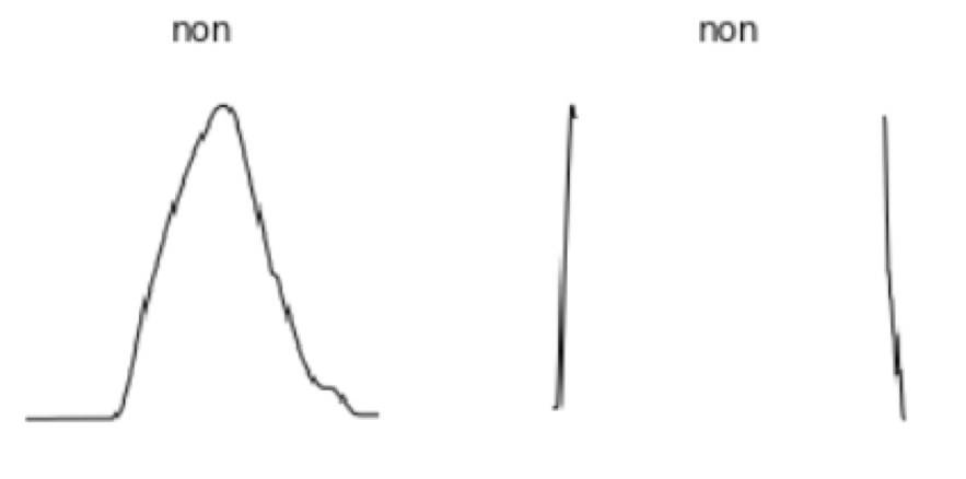 Figure 1.2 Non-typical vertical flight path examples due to insignificant cruise section (left) and missing data (right)